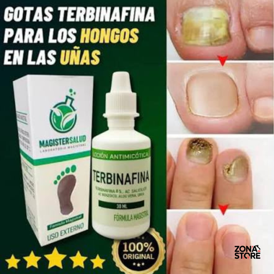 Terbinafina en Gotas 2 en 1